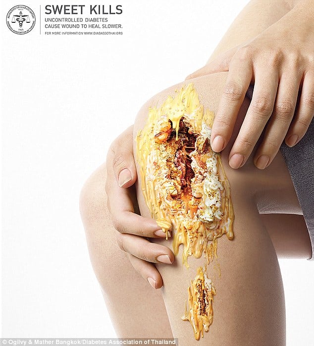 Diabetes campaign shows how too much sugar can cause gaping wounds and ...