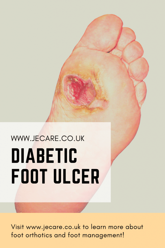 Diabetic Foot Ulcers Diagnosis