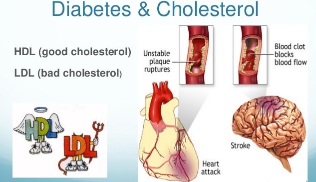 High Cholesterol and Diabetes: What to Eat or Not?