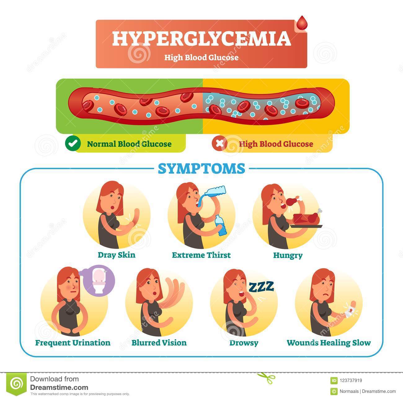 Hyperglycemia Vector Illustration Collection Set. Isolated Symptom ...