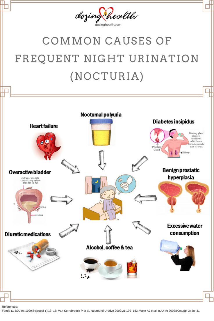 [Infographic] Common Causes of Frequent Night Urination (Nocturia ...