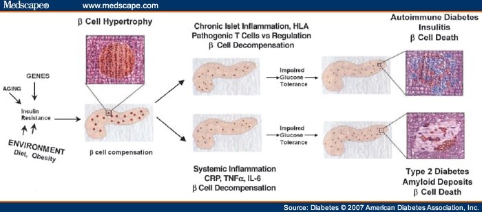 Is Systemic Inflammation Related to Islet Autoimmunity?