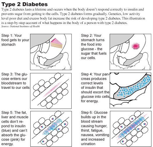 Low Blood Sugar Symptoms Diabetes Type 2 ...