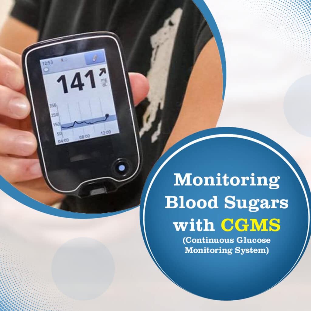 Monitoring Blood Sugars with CGMS