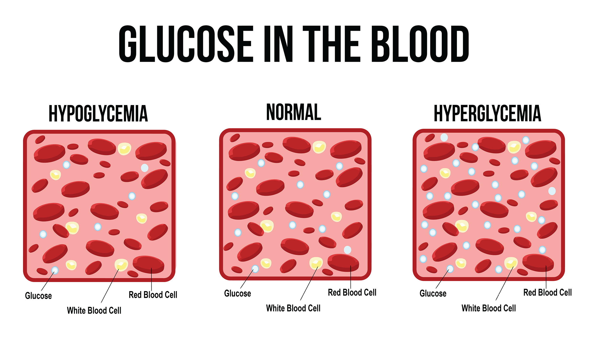 What is Hyperglycemia?